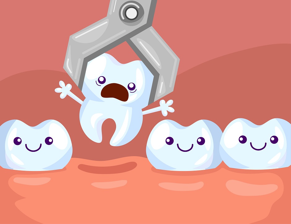 Tooth extraction Connelly Springs