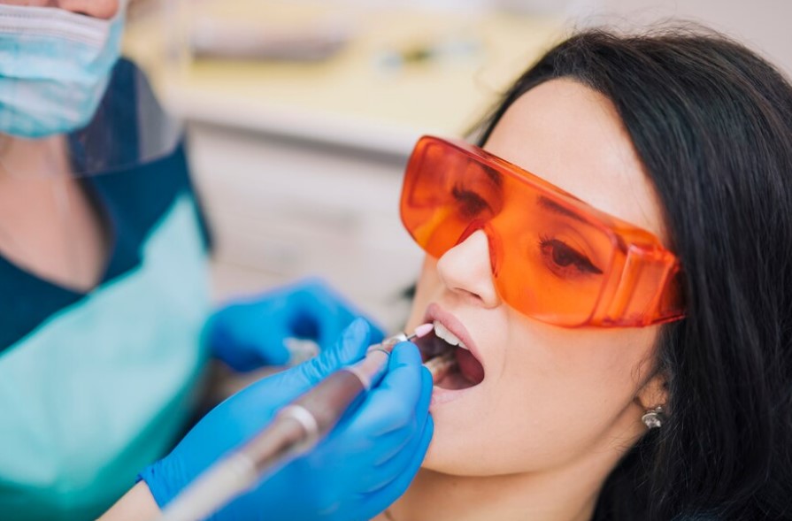 Tooth-Colored Fillings