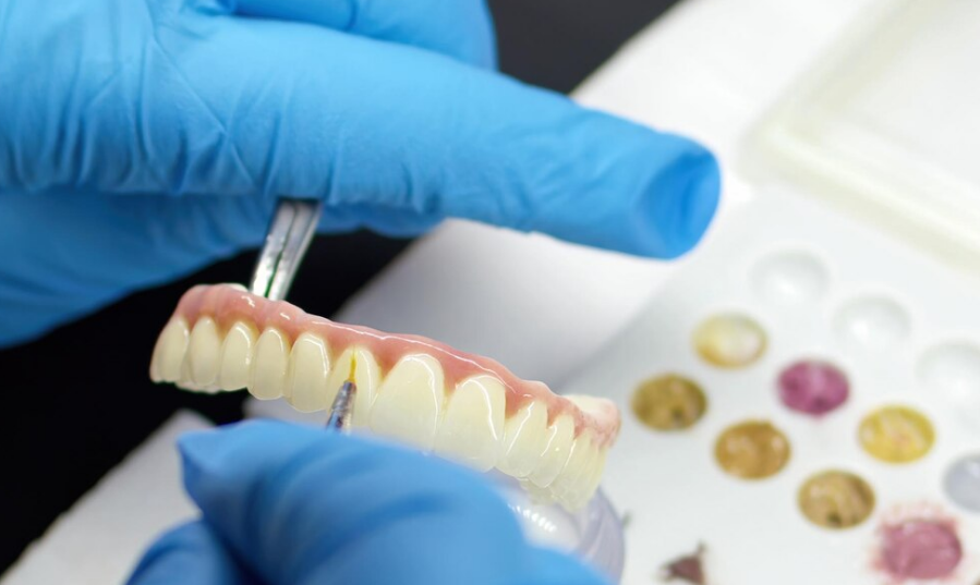 Dental Bridge