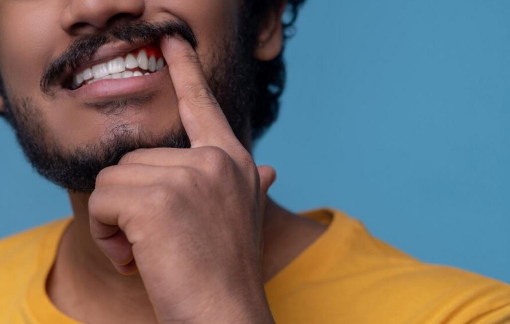 periodontal disease in Valdese