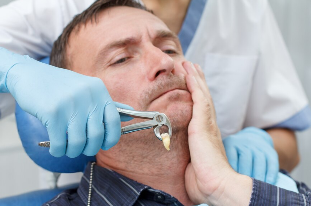 Extracted Teeth