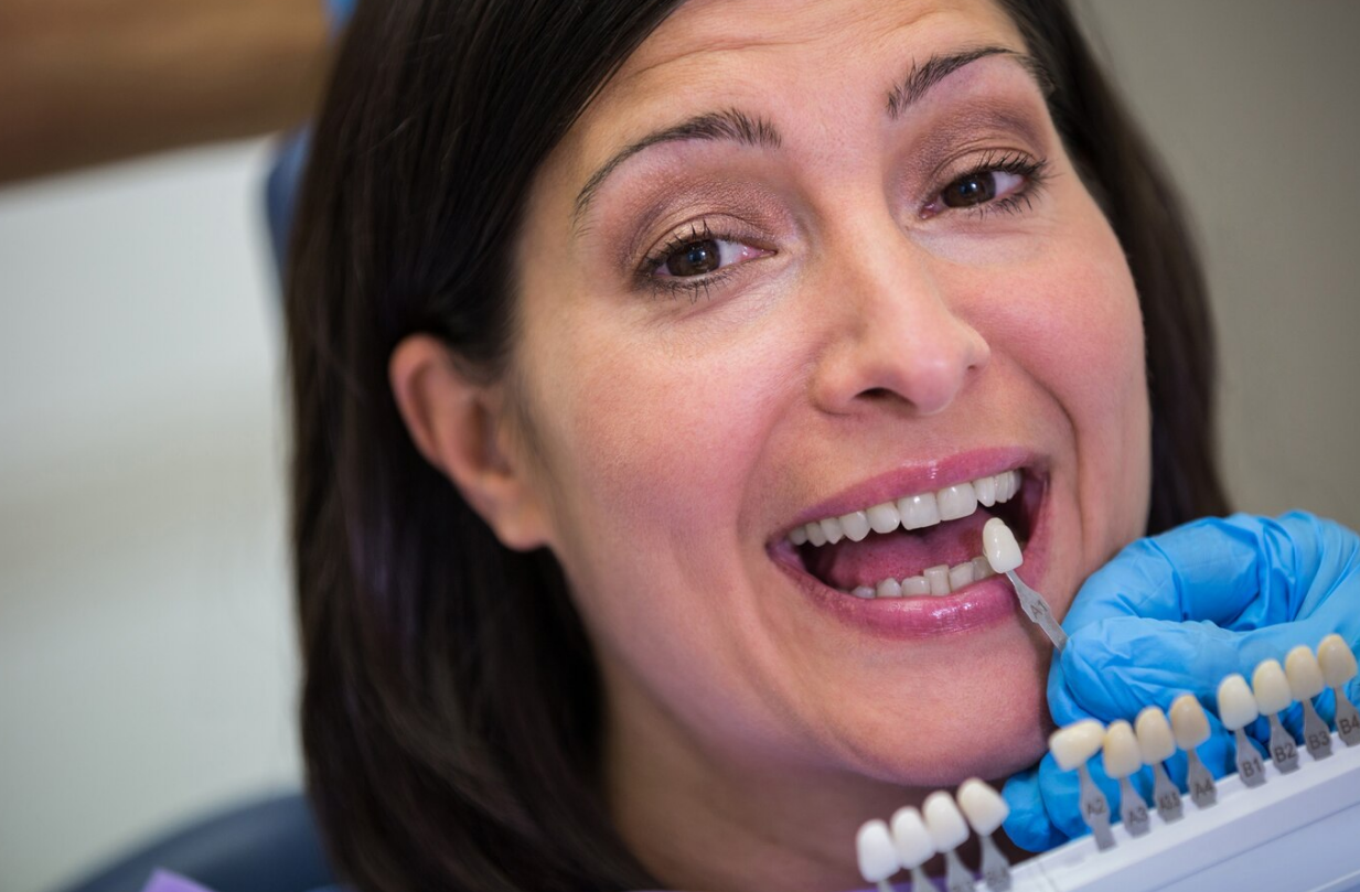 Dental Sealants