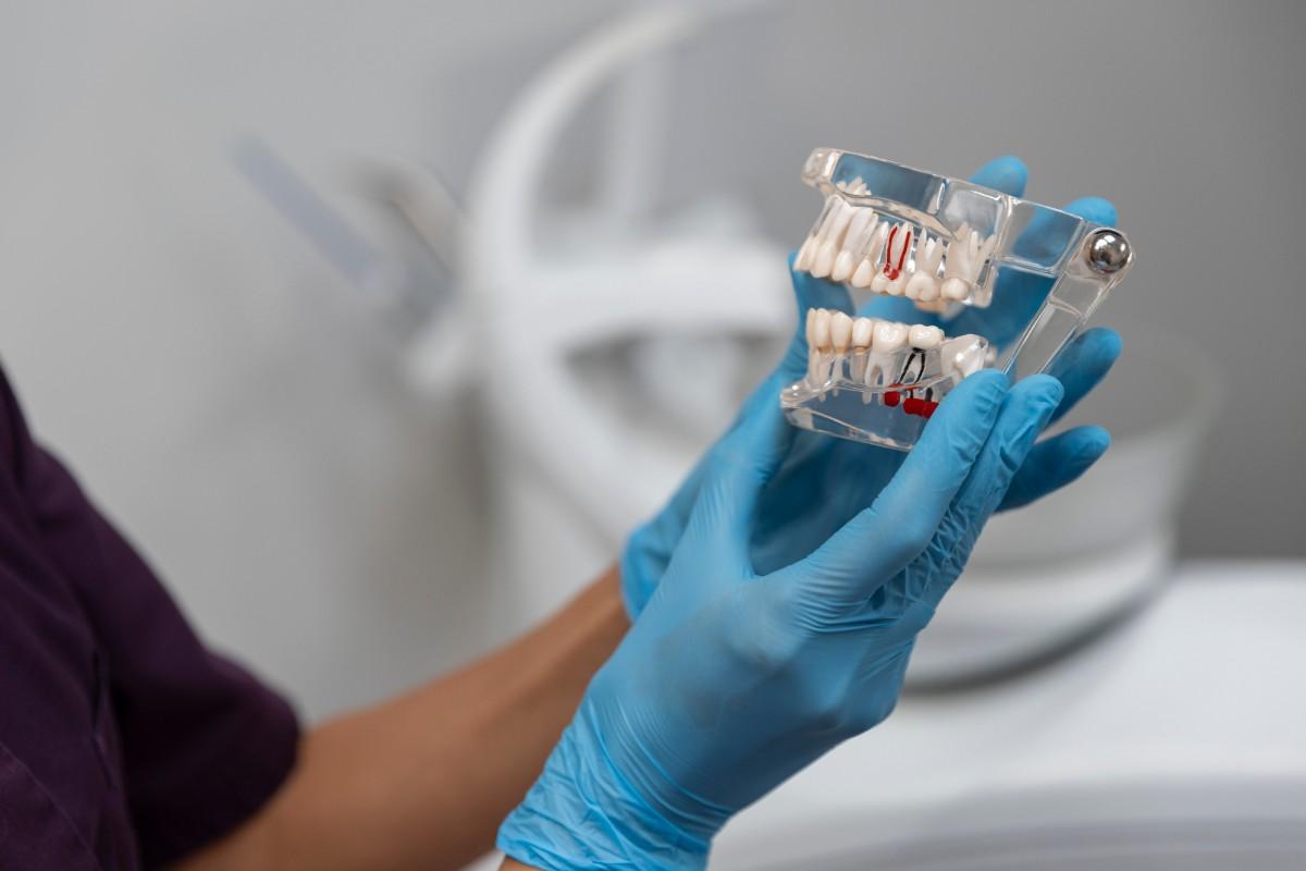 Dental Bridge