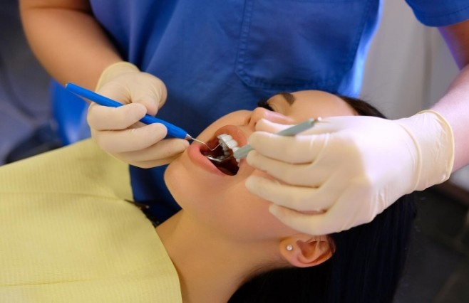Tooth-Colored Fillings