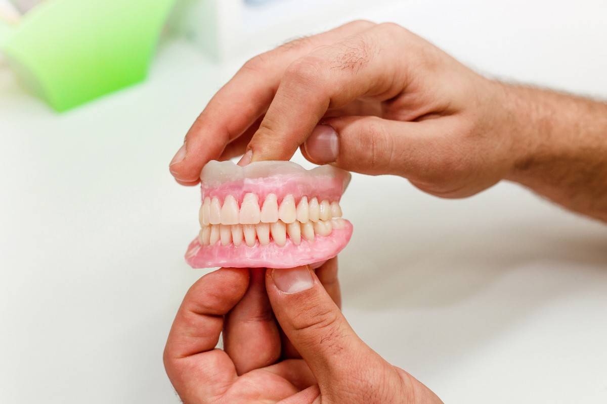 partial dentures