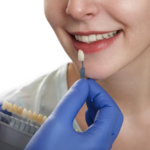 dental crowns